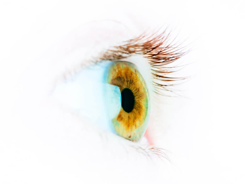 Vision